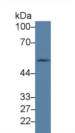 PVRL3 / Nectin-3 Antibody (aa171-377)