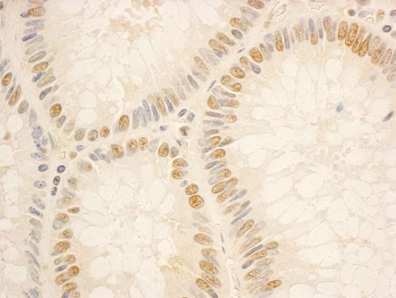 Polyclonal Rabbit anti-Human NOL5A / NOP56 Antibody (aa544-594, IHC, WB)