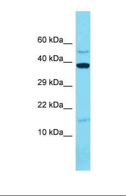 MRPL14 Antibody (C-Terminus)