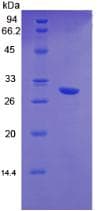 Human HGF / Hepatocyte Growth Factor Protein (Recombinant His-T7)