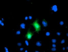 CDKN3 / KAP Antibody (clone OTI1H5)