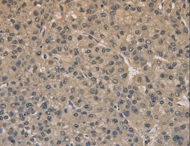 DRG1 / NEDD3 Antibody