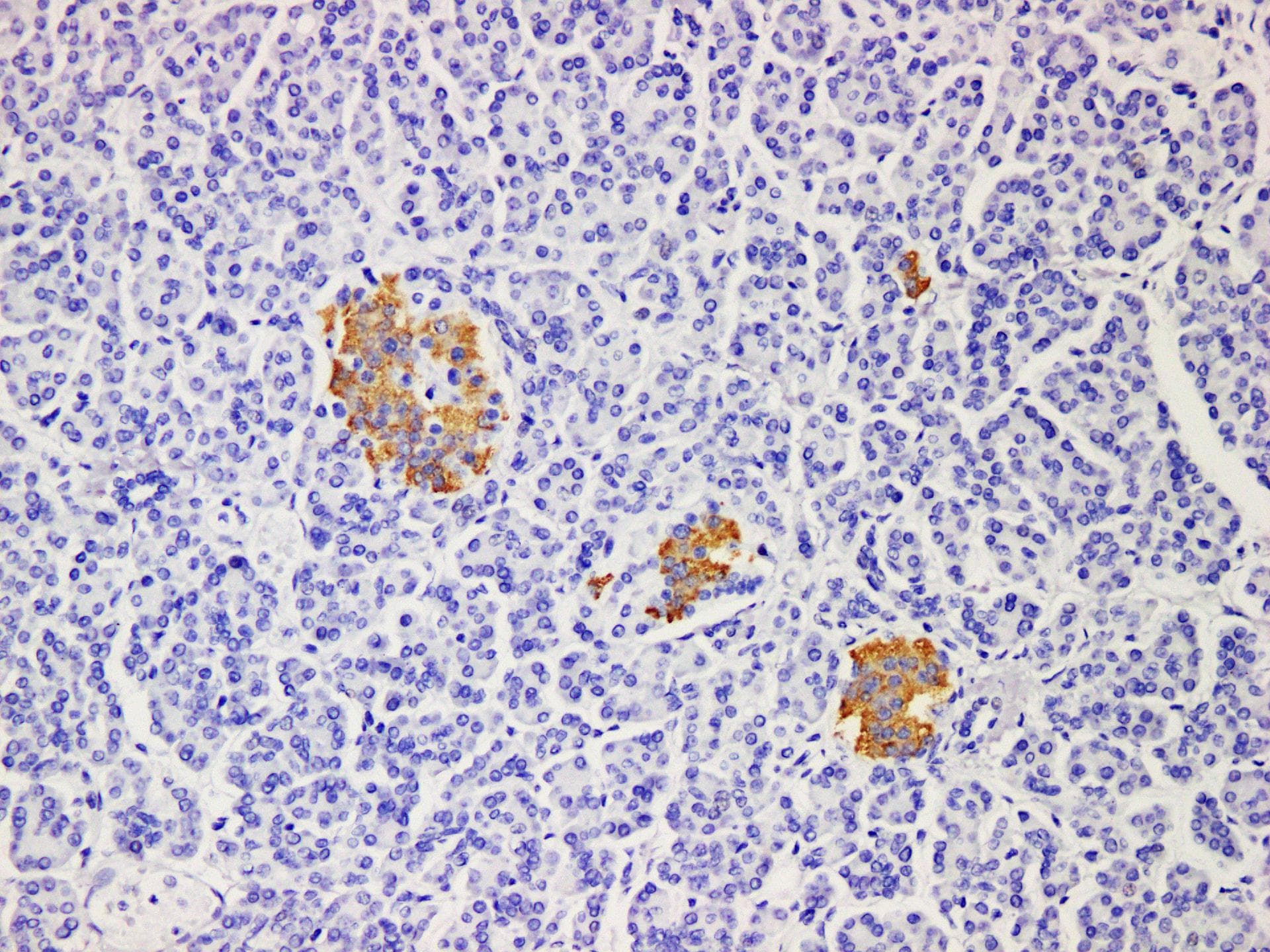 Insulin Antibody