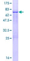 Human RTCD1 / RPC Protein (Recombinant GST)