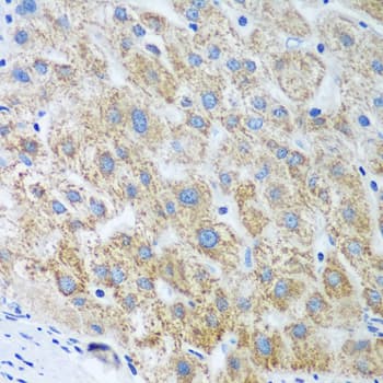 Polyclonal Rabbit anti-Human UBE2U Antibody (IHC, WB)