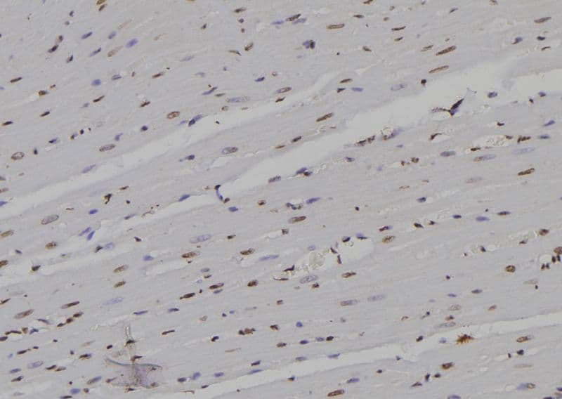RPB16 / POLR2D Antibody