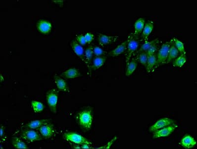 IHC-plus™ HLA-B Antibody
