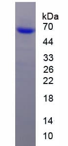 Mouse RYR1 / RYR Protein (Recombinant His-GST, N-terminus)
