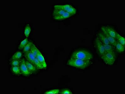 GIPC1 / GIPC Antibody