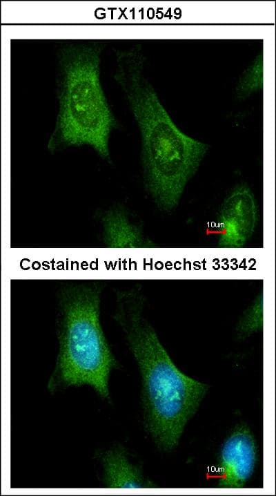 Polyclonal Rabbit anti-Human PTS Antibody (aa1-145, IHC, WB)