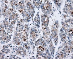 p66 / SHC Antibody (clone OTI1H8)