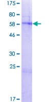 Human FAHD2A Protein (Recombinant GST)