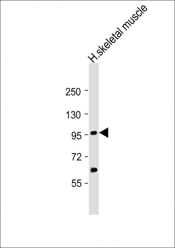YY1AP1 Antibody (aa437-468)