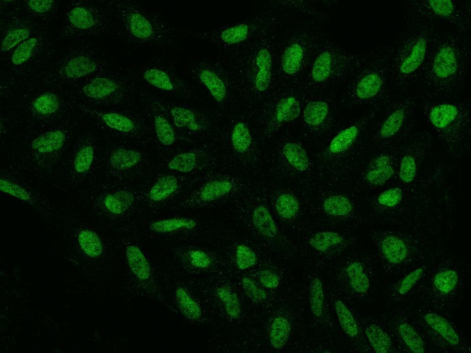 Polyclonal Rabbit anti-Human HDGFRP2 Antibody (IHC, IF)