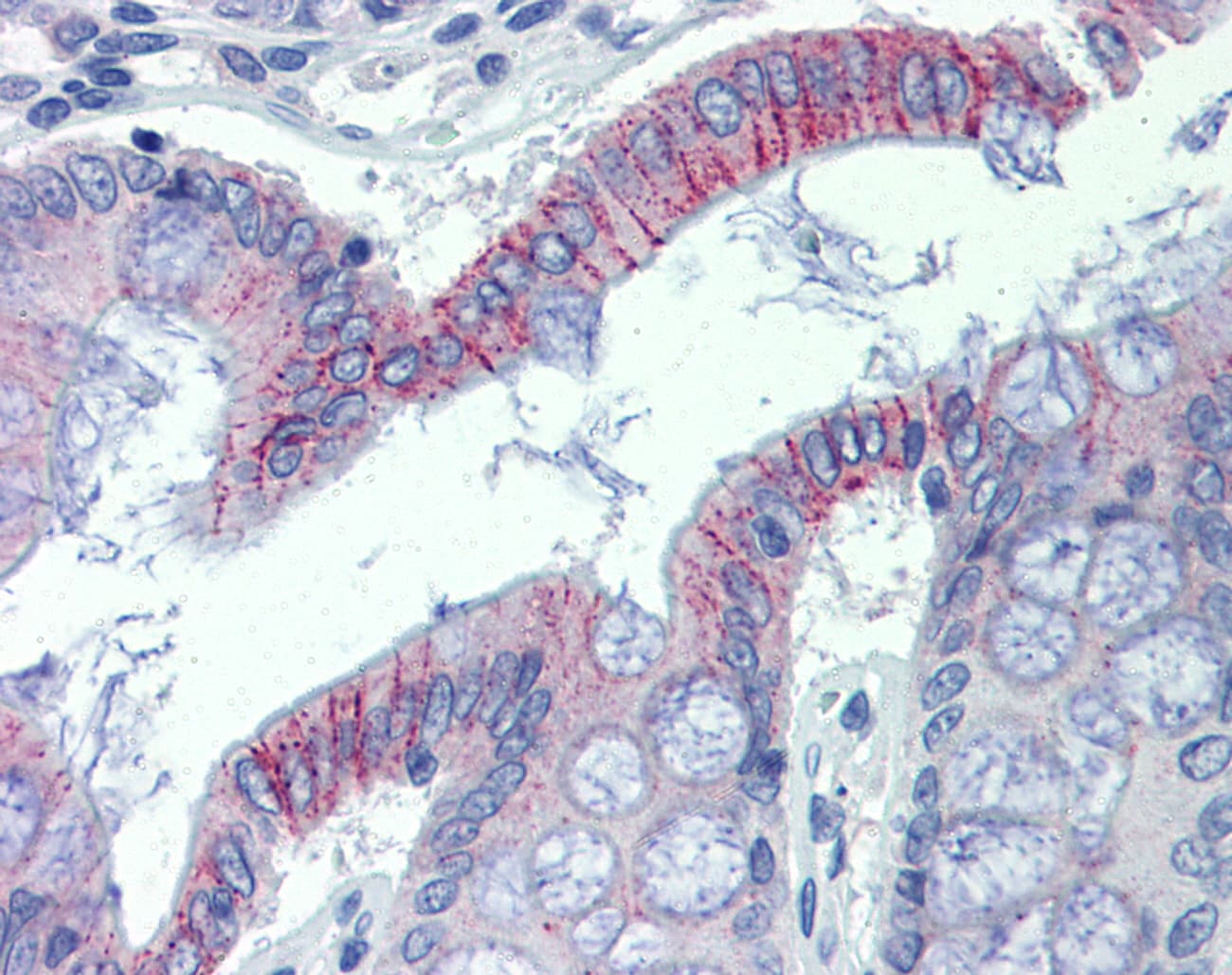 Polyclonal Rabbit anti-Human DSG2 / Desmoglein 2 Antibody (aa72-121, IHC, WB)