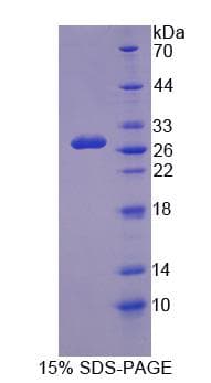 Human GUCY1B3 Protein (Recombinant His-S)