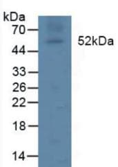 LPL / Lipoprotein Lipase Antibody (aa55-316)