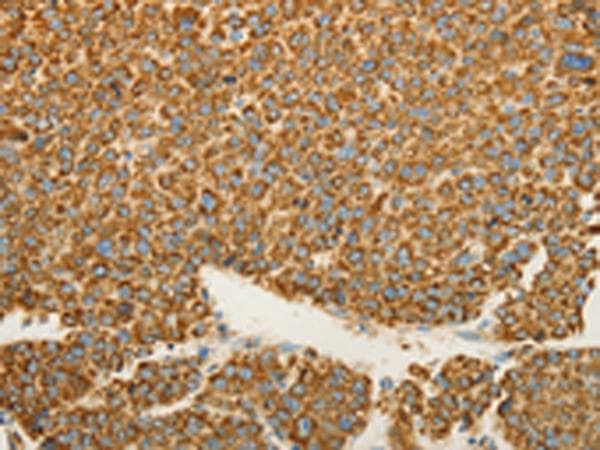 VDAC2 Antibody