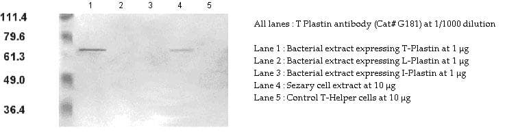 PLS3 / T Plastin Antibody