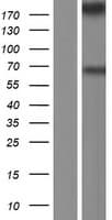 MYOF / Myoferlin Protein (Over-Expression Lysate Myc-DDK (Flag))