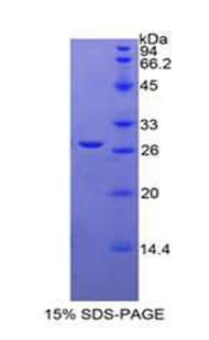 Human FLT3LG / Flt3 Ligand Protein (Recombinant His, N-Terminal)