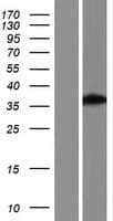 EXOG / ENDOGL1 Protein (Over-Expression Lysate Myc-DDK (Flag))