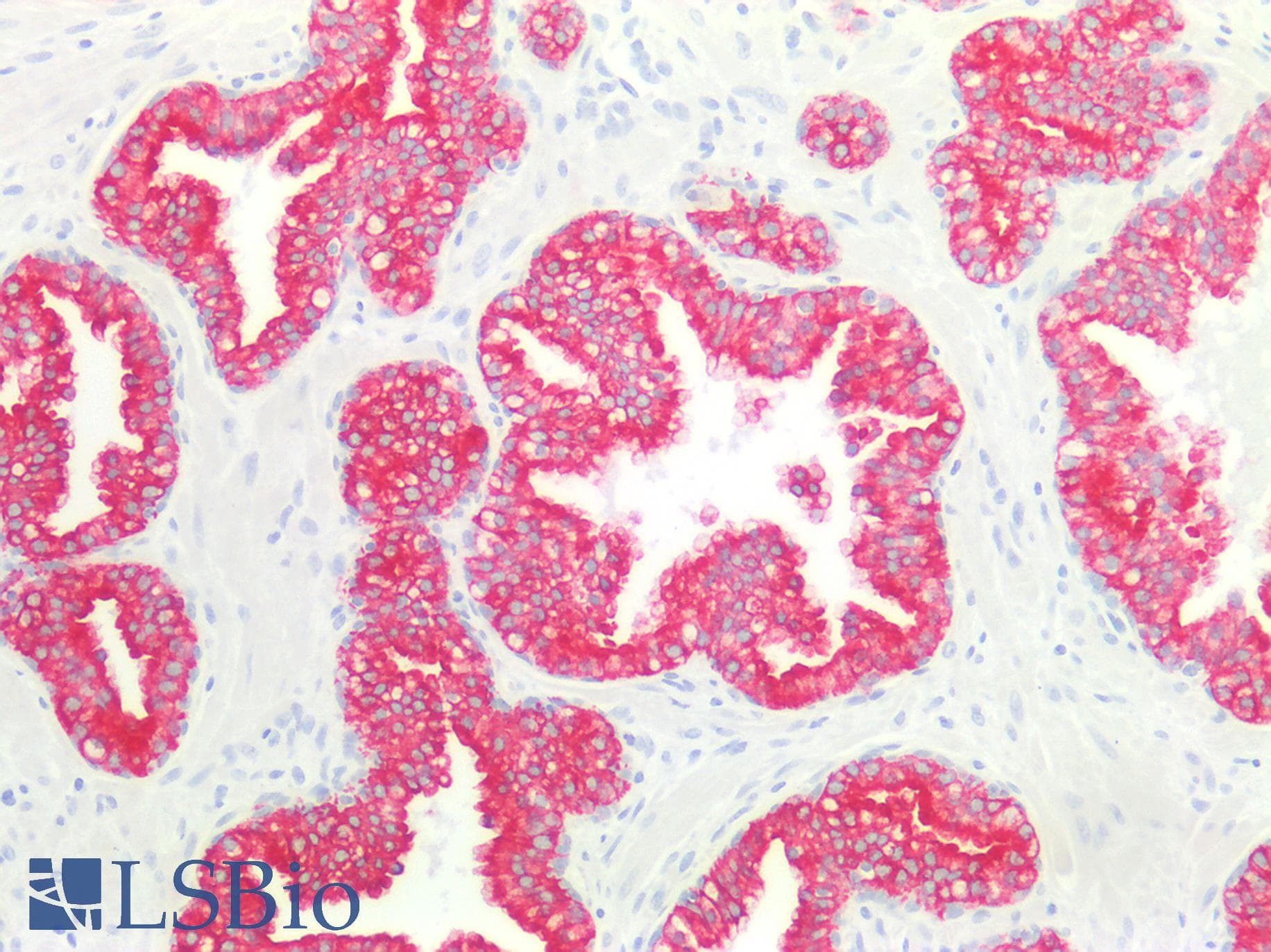 PathPlus™ KRT18 / CK18 / Cytokeratin 18 Antibody