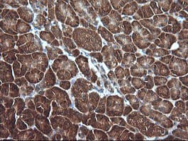 MLANA / Melan-A Antibody (clone OTI3A2)