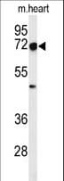 IHC-plus™ Polyclonal Rabbit anti-Human DCLRE1C / Artemis Antibody (aa21-50, IHC, WB)