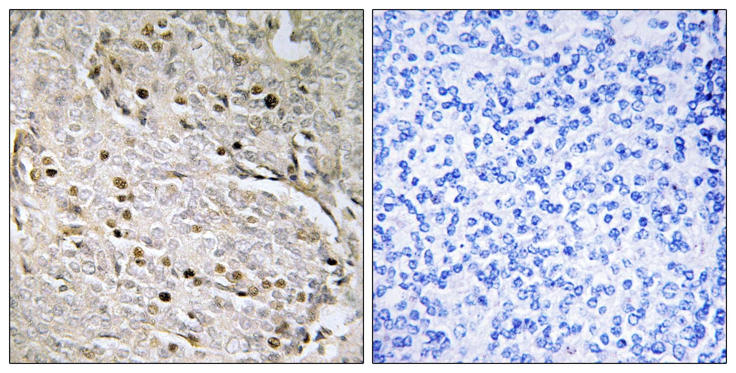 POTEA / POTE8 Antibody