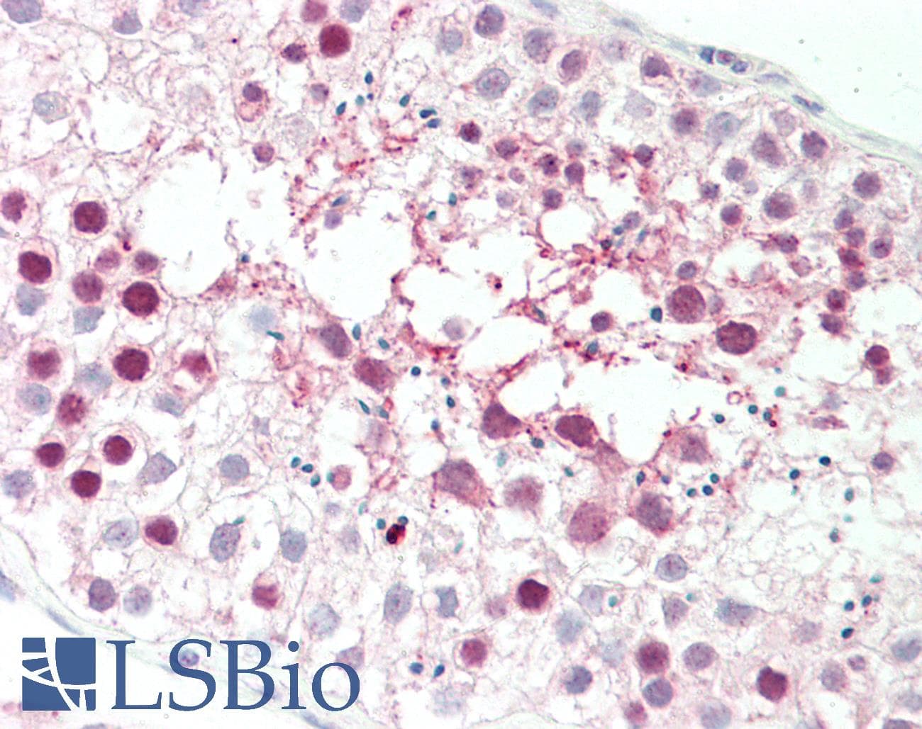 IHC-plus™ CENPU / MLF1IP Antibody