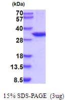 Human CA13 / Carbonic Anhydrase XIII Protein (Recombinant His)