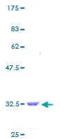 Human TMSB10 / Thymosin Beta 10 Protein (Recombinant GST)