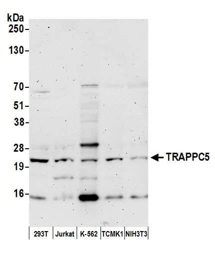 TRAPPC5 Antibody (aa138-188)