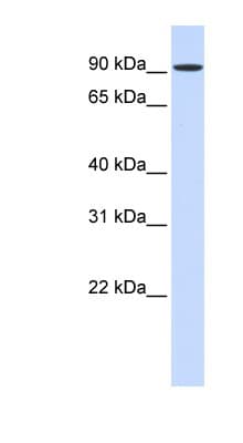HSPH1 / HSP105 Antibody (aa504-553)