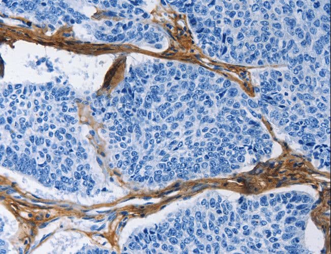PathPlus™ COL3A1 / Collagen III Antibody