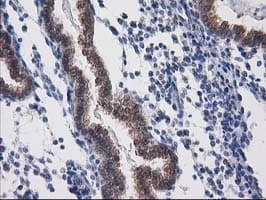 Monoclonal Mouse anti-Human DSTN / Destrin Antibody (clone OTI1B8, IHC, WB)