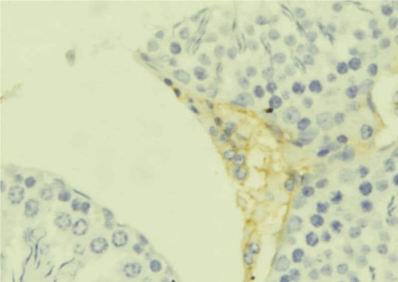 IL25 / IL17E Antibody