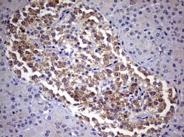 DICER1 / Dicer Antibody (aa1666-1922, clone OTI1E11)