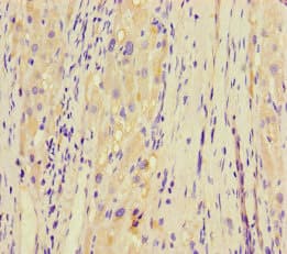 Polyclonal Rabbit anti-Human KCTD16 Antibody