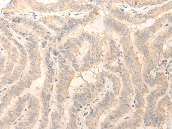 ERP27 Antibody