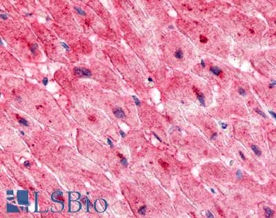 PathPlus™ ADGRL4 / ELTD1 Antibody (N-Terminus)