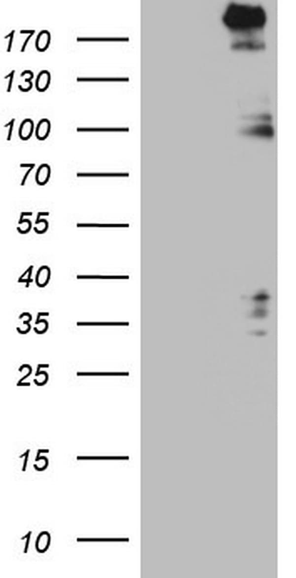 SETD1A / SET1 Antibody (aa1-320, clone OTI1D3)