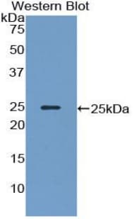 NEFM / NF-M Antibody (aa105-287)
