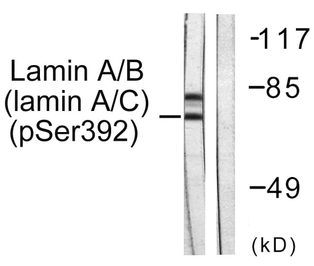 LMNA / Lamin A+C Antibody (phospho-Ser392)