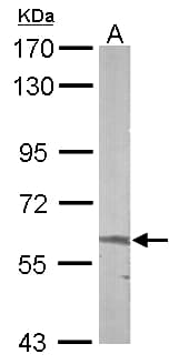 ALAS2 Antibody (aa211-587)