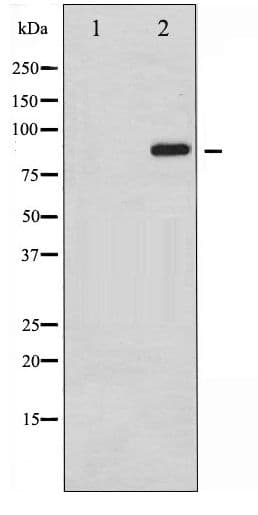 STAT6 Antibody (phospho-Tyr641)