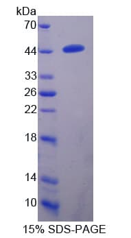 Human TMPRSS4 Protein (Recombinant His,N-terminus)