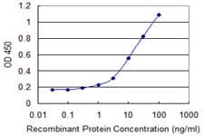 CTTN / Cortactin Antibody (clone 2B5)