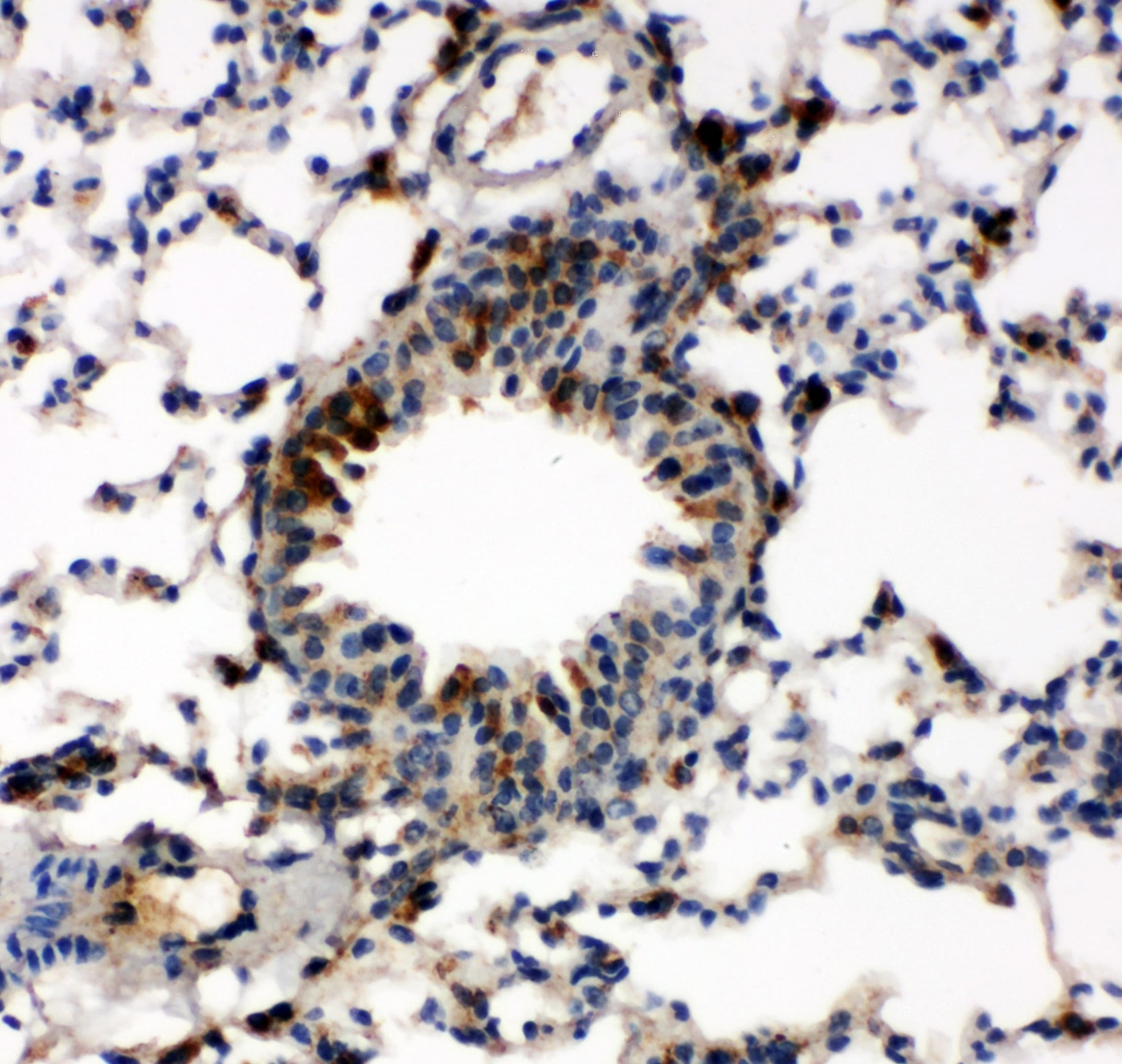 CASP6 / Caspase 6 Antibody (aa7-27)